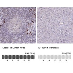 IL-18 BPa/IL18BP Antibody, Novus Biologicals:Antibodies:Primary Antibodies